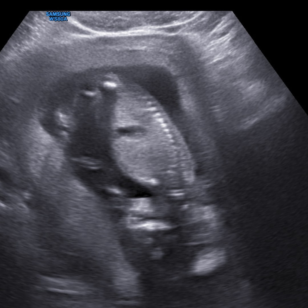 Photo shared by Nathalie for their Babylist baby registry.