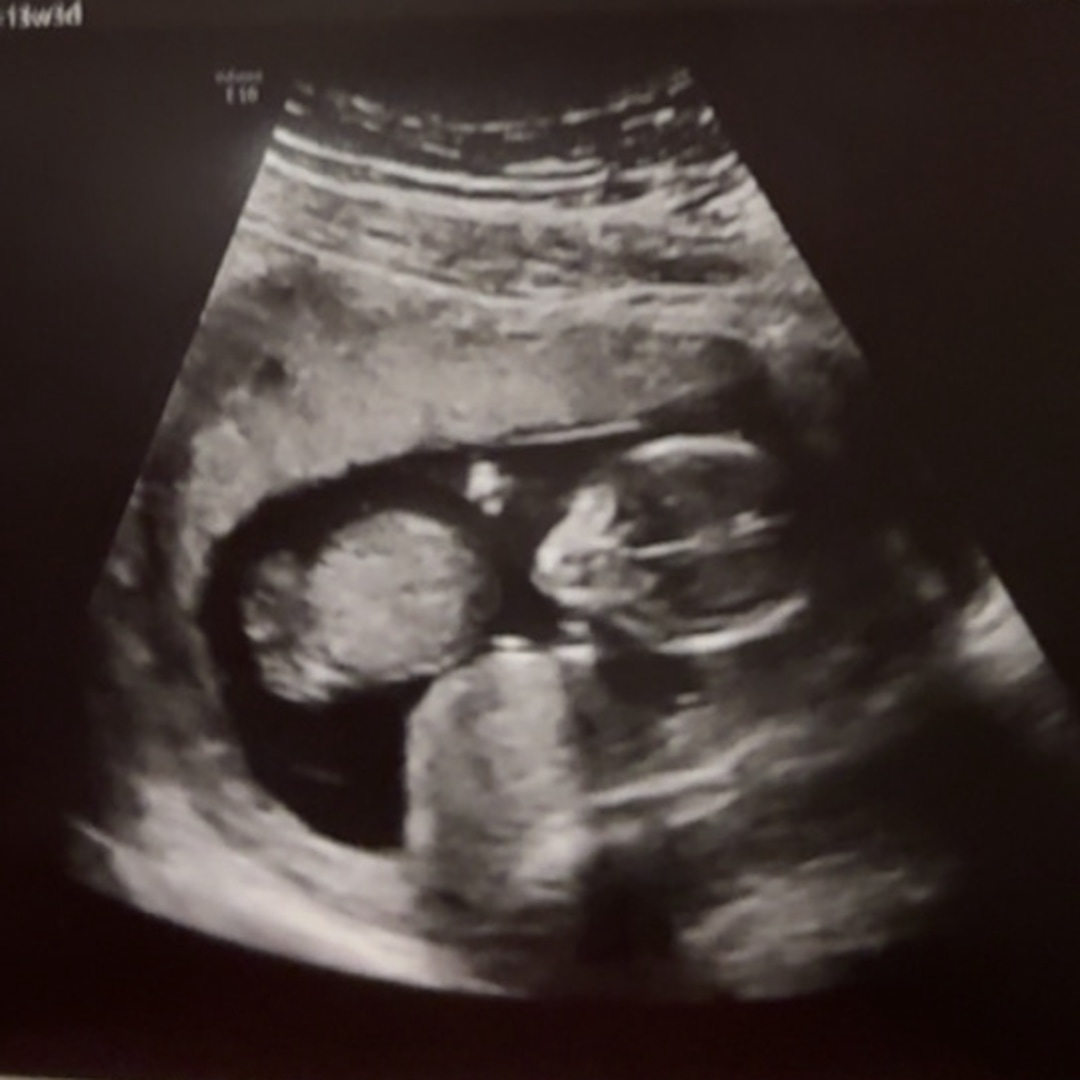 Photo shared by Callan for their Babylist baby registry.