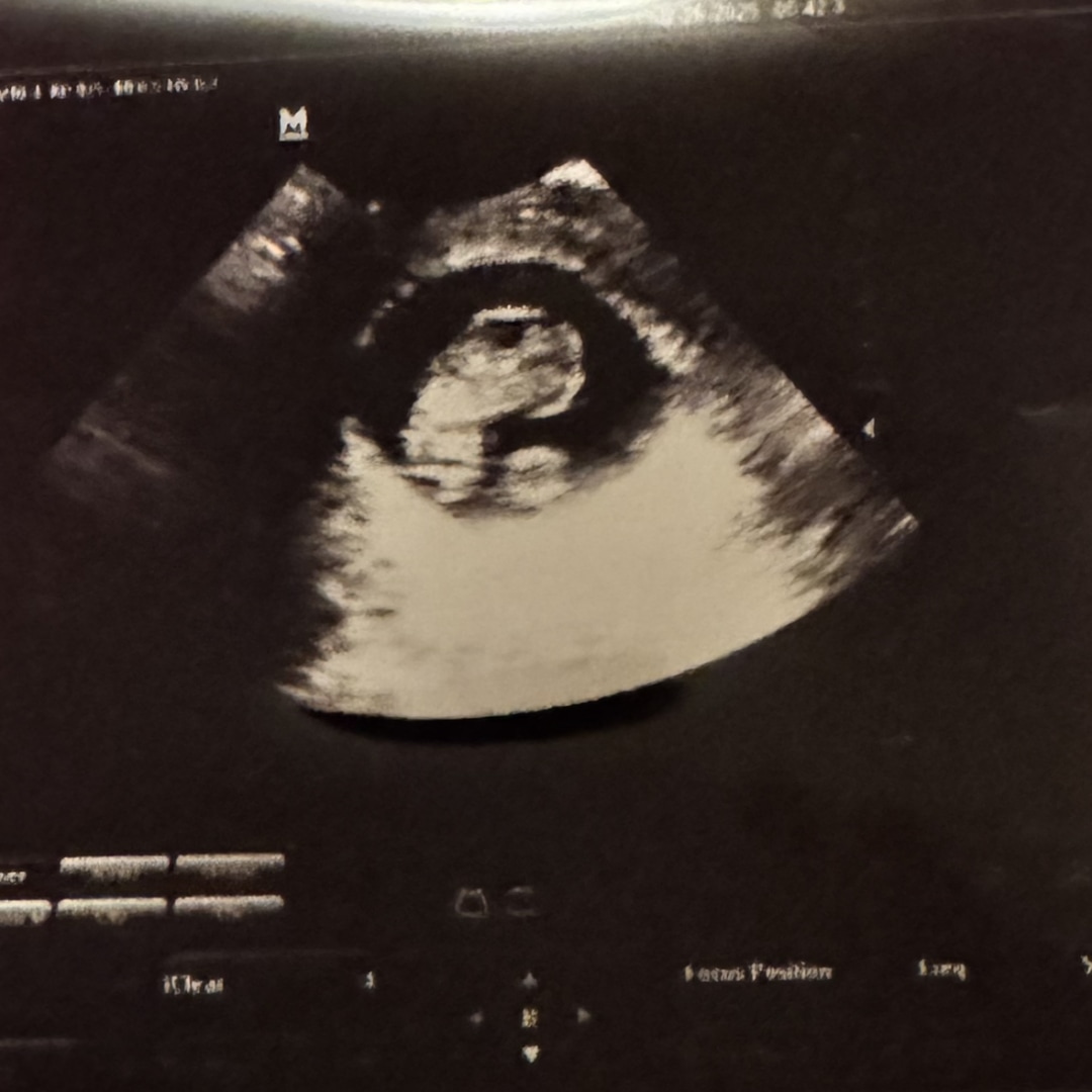 Photo shared by Nicole for their Babylist baby registry.