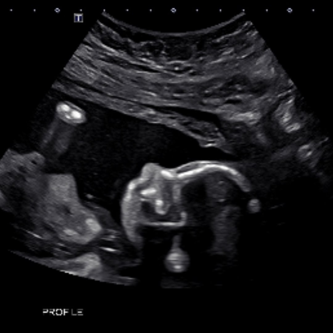 Photo shared by Brooklyn for their Babylist baby registry.