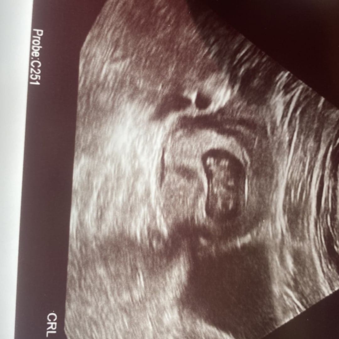 Photo shared by Rose for their Babylist baby registry.