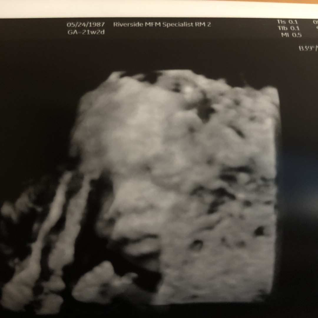 Photo shared by Felicia for their Babylist baby registry.