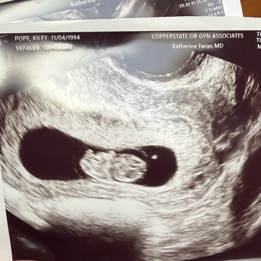 Photo shared by Kiley for their Babylist baby registry.