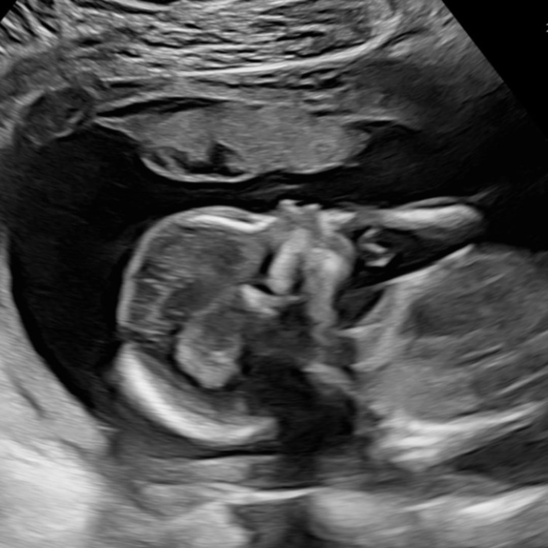 Photo shared by Honesty for their Babylist baby registry.