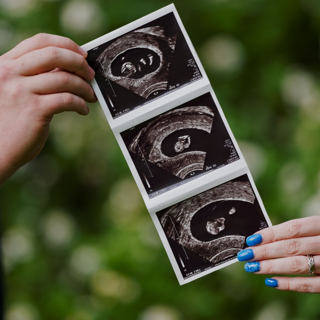 Photo shared by Emily for their Babylist baby registry.