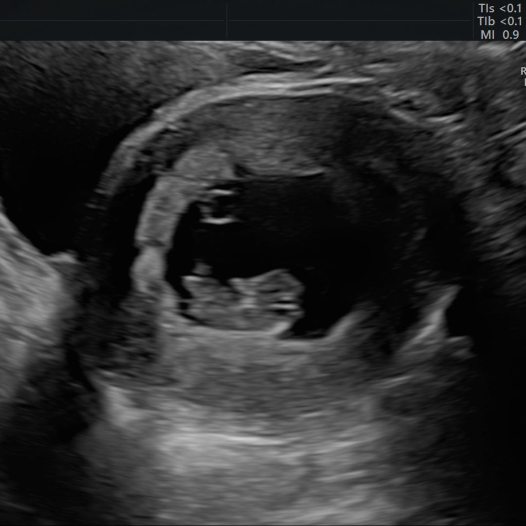 Photo shared by Kailey for their Babylist baby registry.