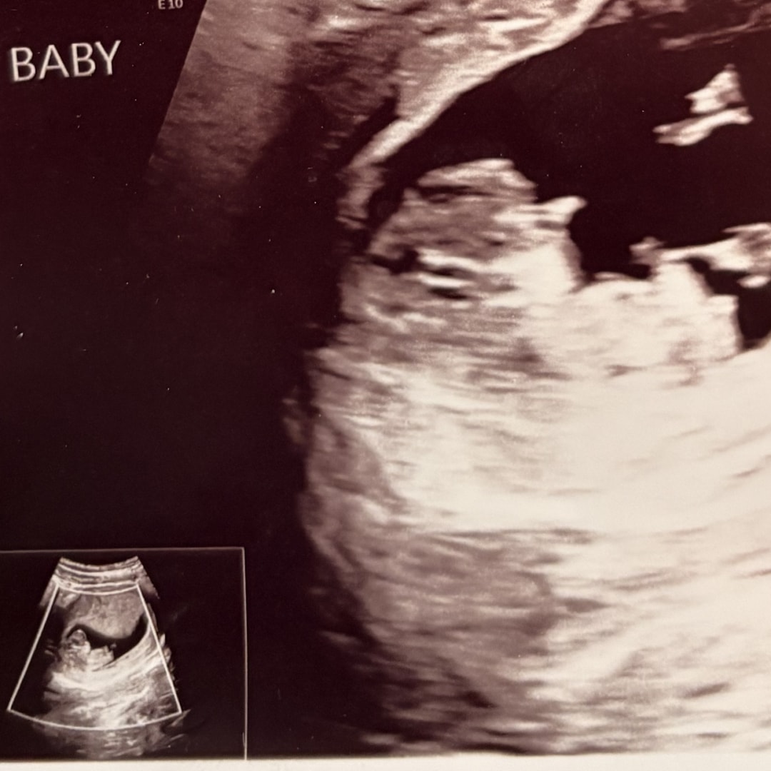 Photo shared by Lexie for their Babylist baby registry.