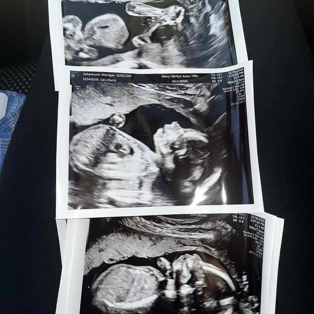 Photo shared by Morrigan for their Babylist baby registry.