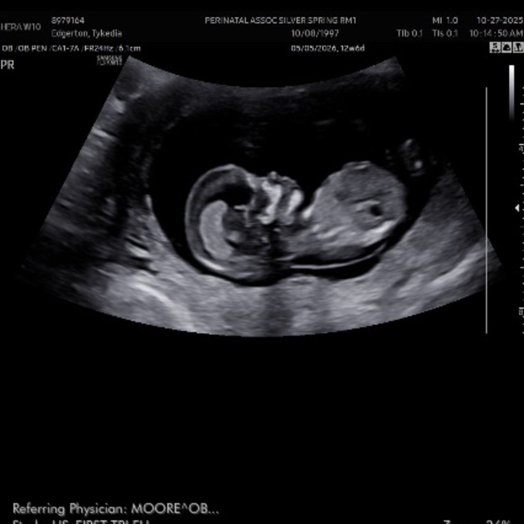 Photo shared by Alexis for their Babylist baby registry.