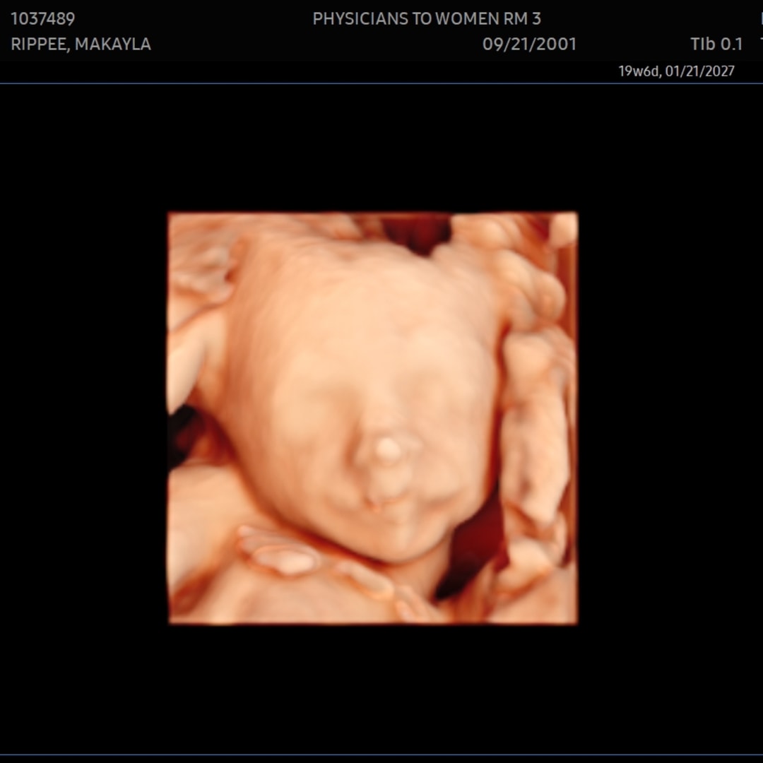 Photo shared by Makayla for their Babylist baby registry.