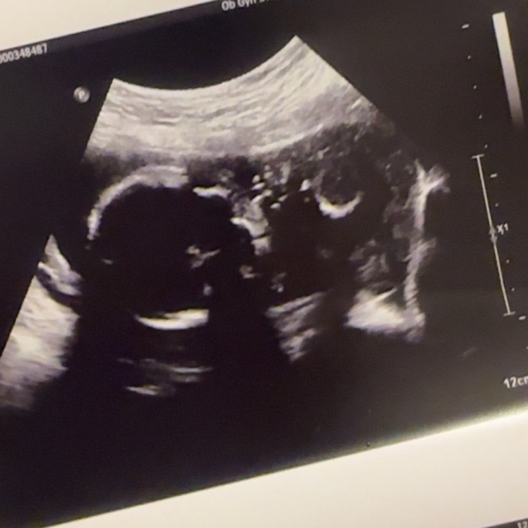 Photo shared by Rosanna for their Babylist baby registry.