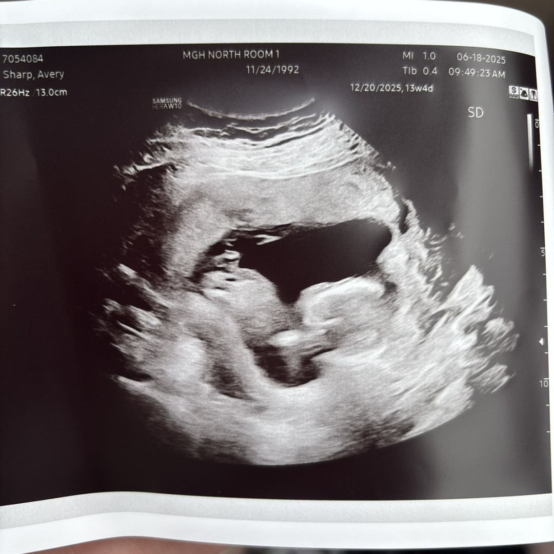 Photo shared by Avery for their Babylist baby registry.