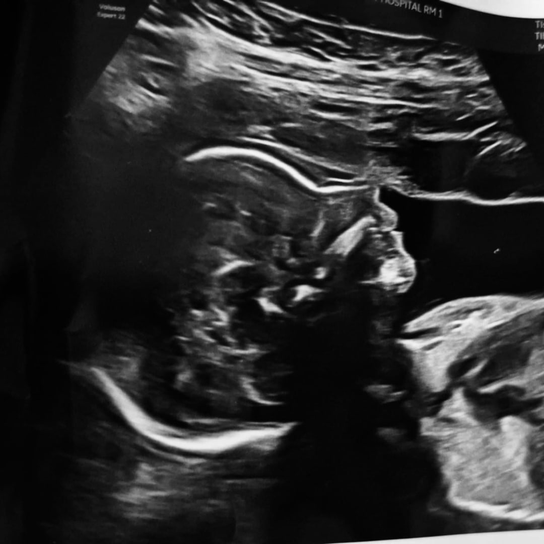Photo shared by Alexandria for their Babylist baby registry.