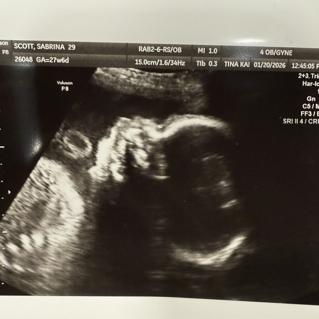 Photo shared by Freya for their Babylist baby registry.