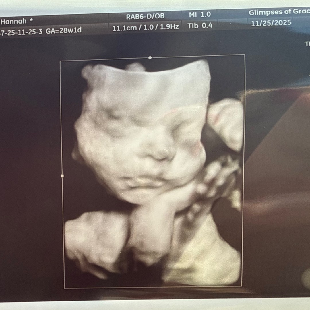 Photo shared by Hannah for their Babylist baby registry.