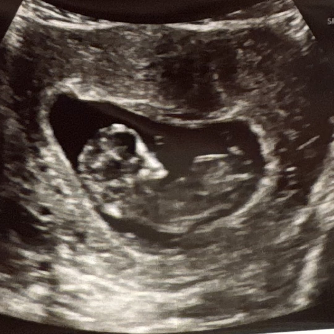 Photo shared by Autumn for their Babylist baby registry.