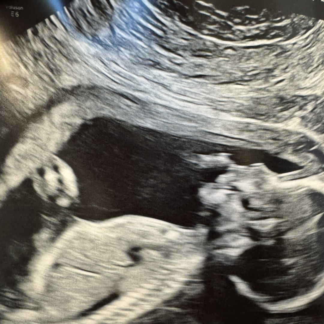 Photo shared by Angela for their Babylist baby registry.