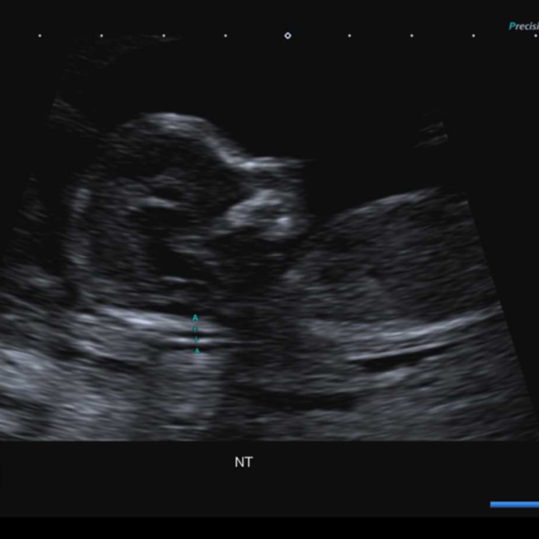 Photo shared by Kaitlyn for their Babylist baby registry.