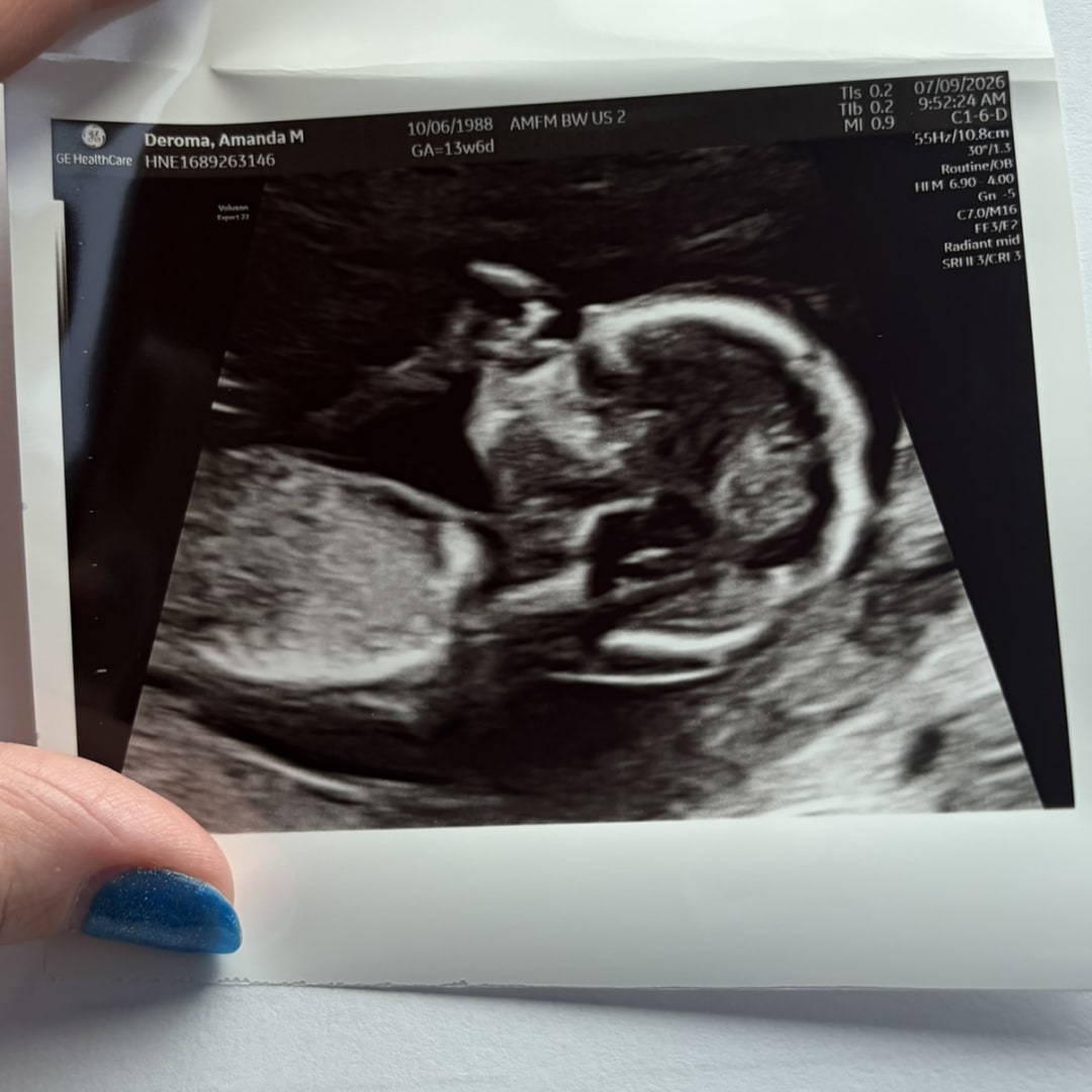Photo shared by Amanda for their Babylist baby registry.
