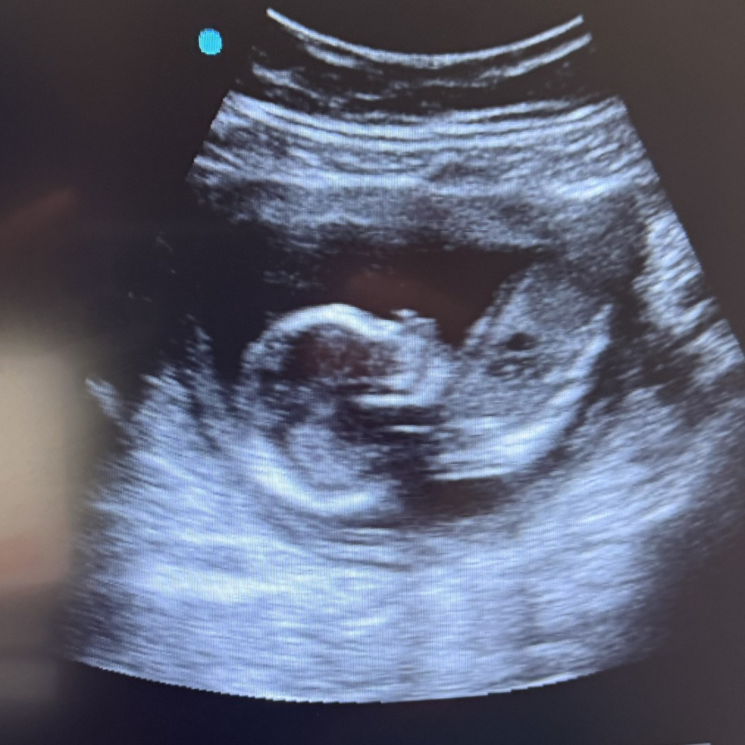 Photo shared by Nhilze for their Babylist baby registry.