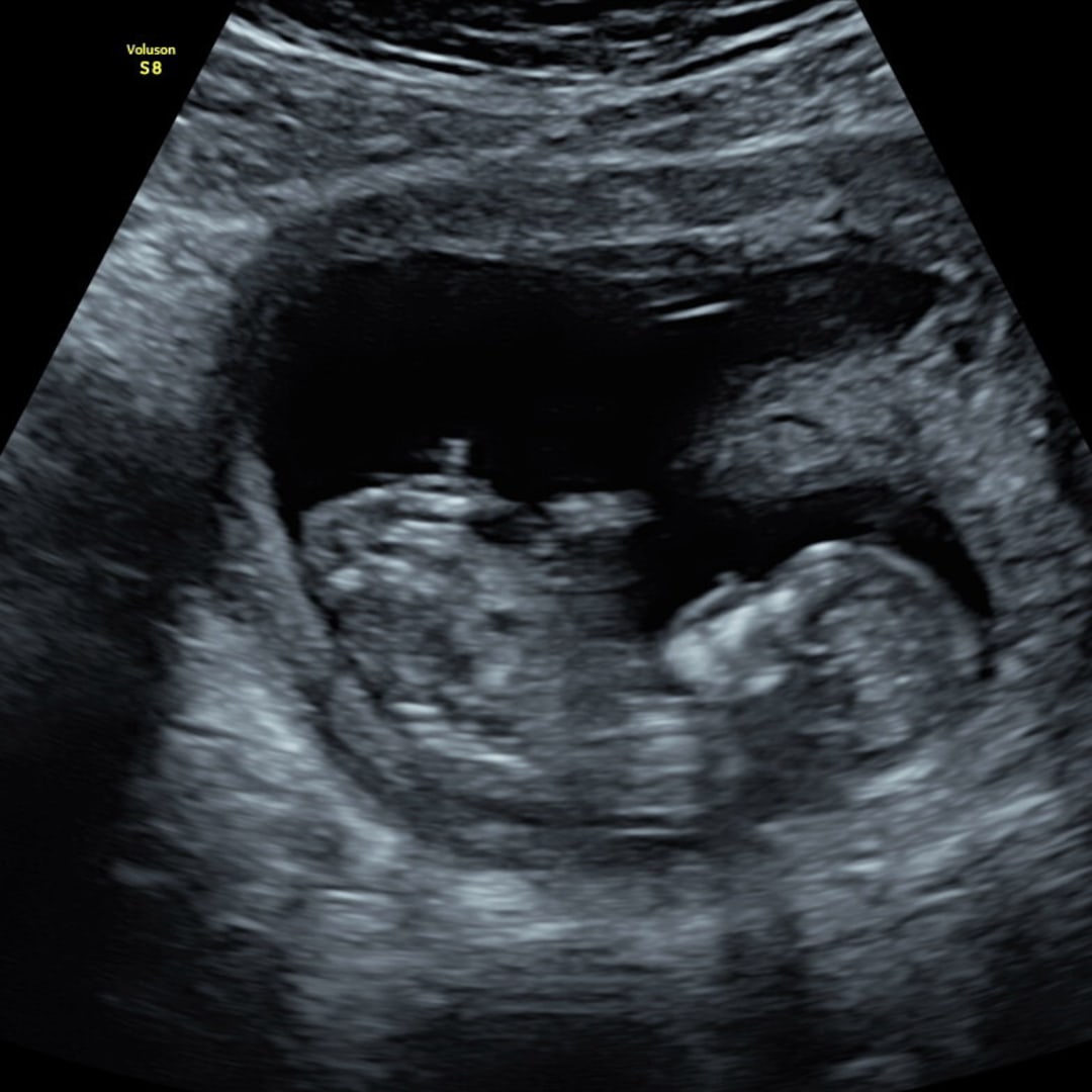 Photo shared by Makenna for their Babylist baby registry.