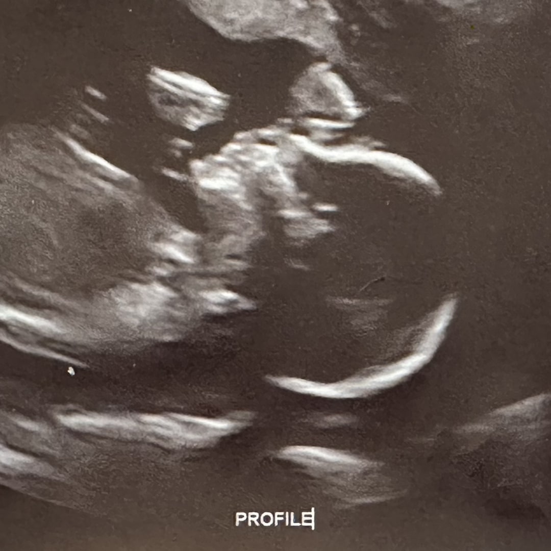 Photo shared by Taylor for their Babylist baby registry.