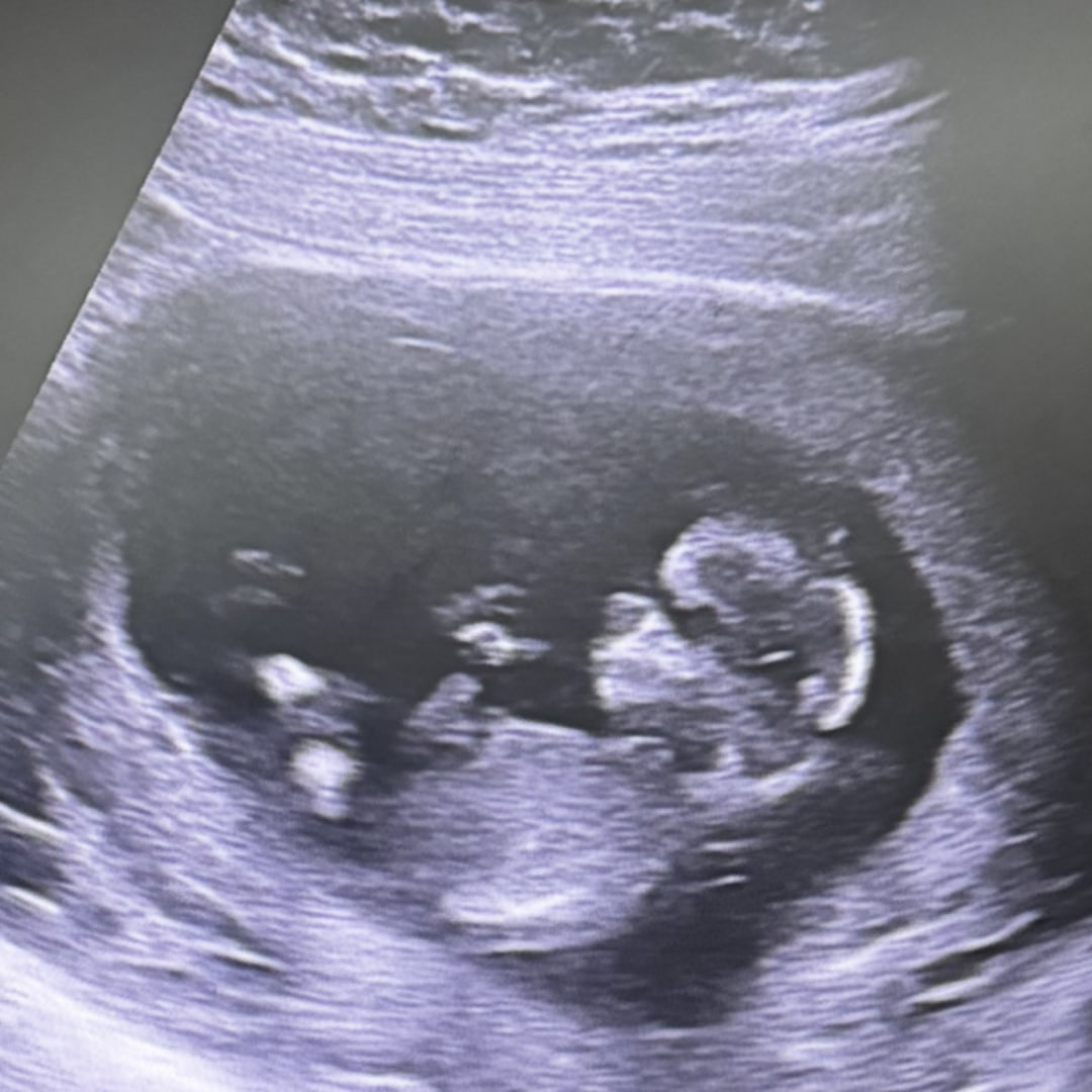 Photo shared by Marisa for their Babylist baby registry.