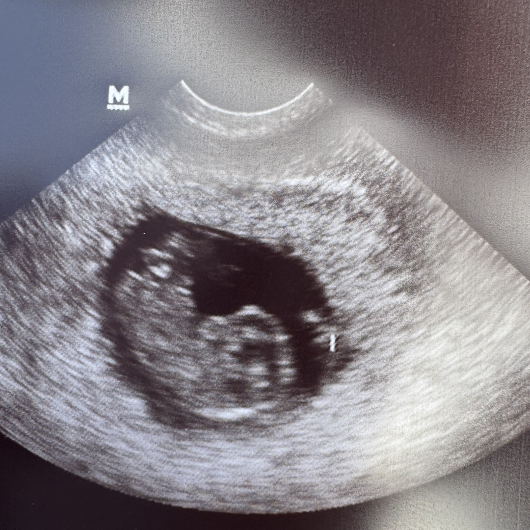 Photo shared by Hannah for their Babylist baby registry.