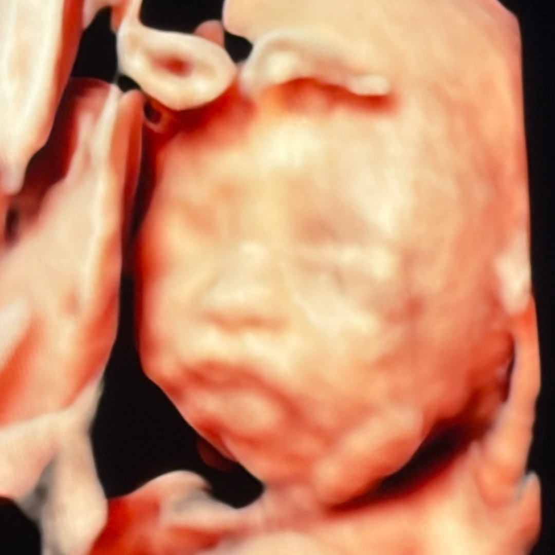 Photo shared by Irisvette for their Babylist baby registry.