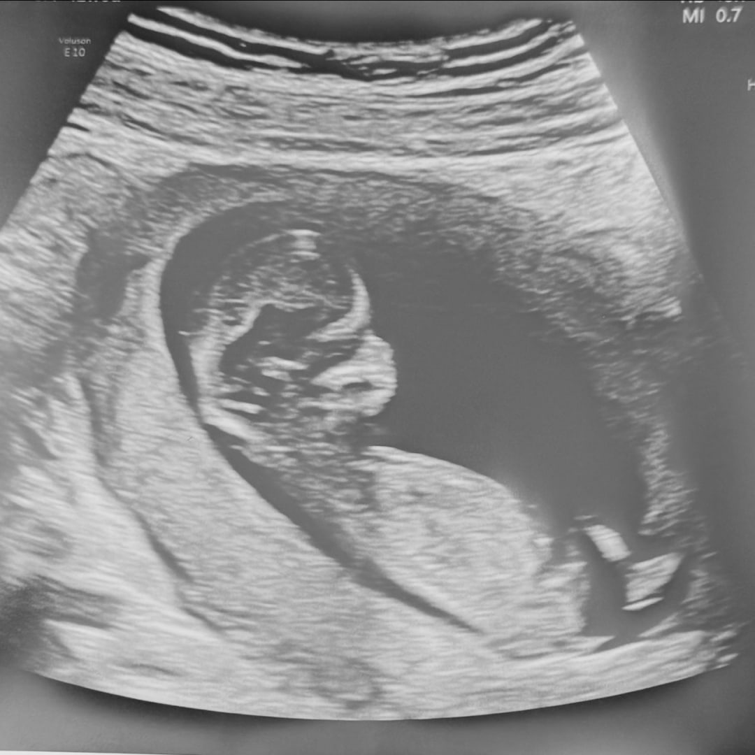 Photo shared by Karen for their Babylist baby registry.
