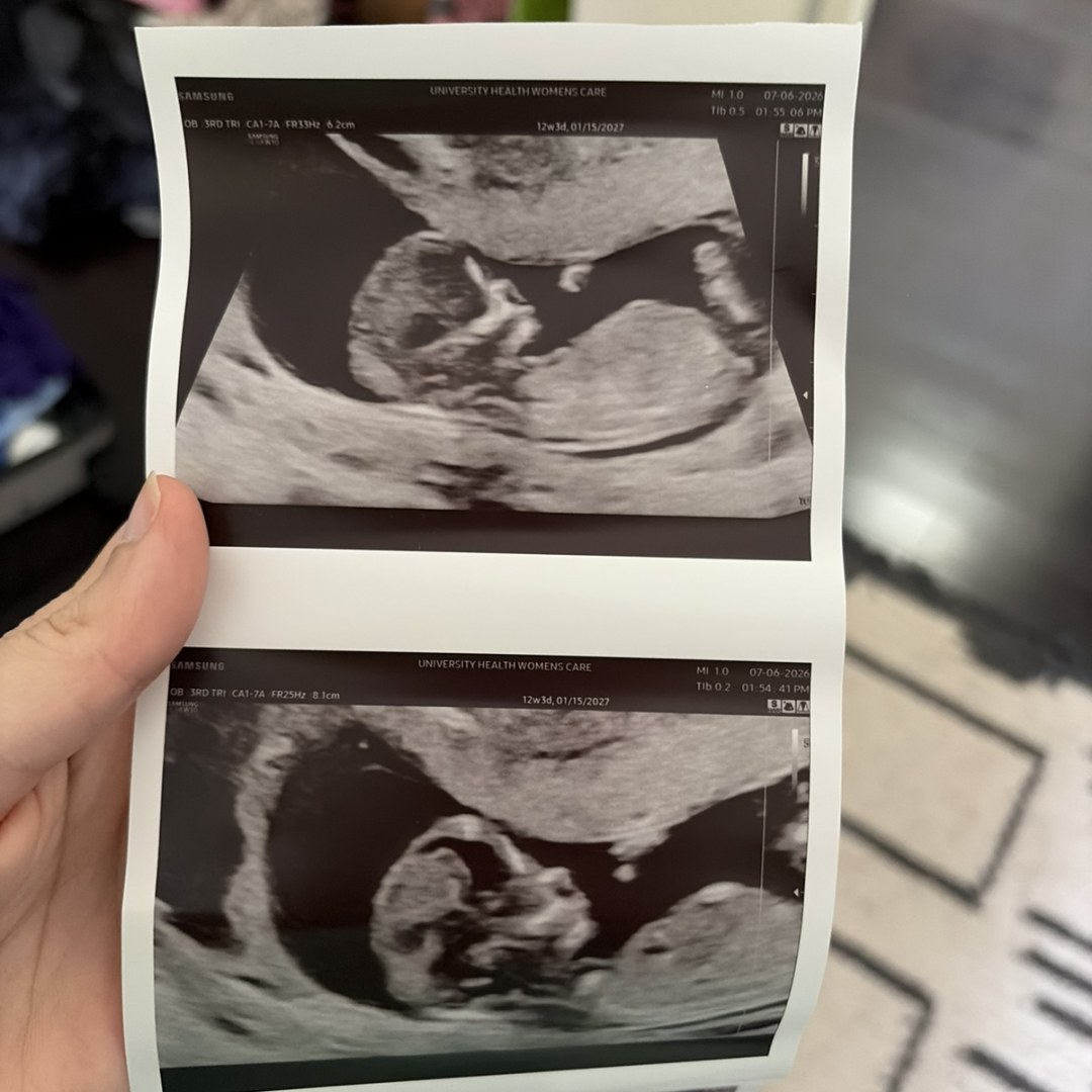 Photo shared by Breanna for their Babylist baby registry.