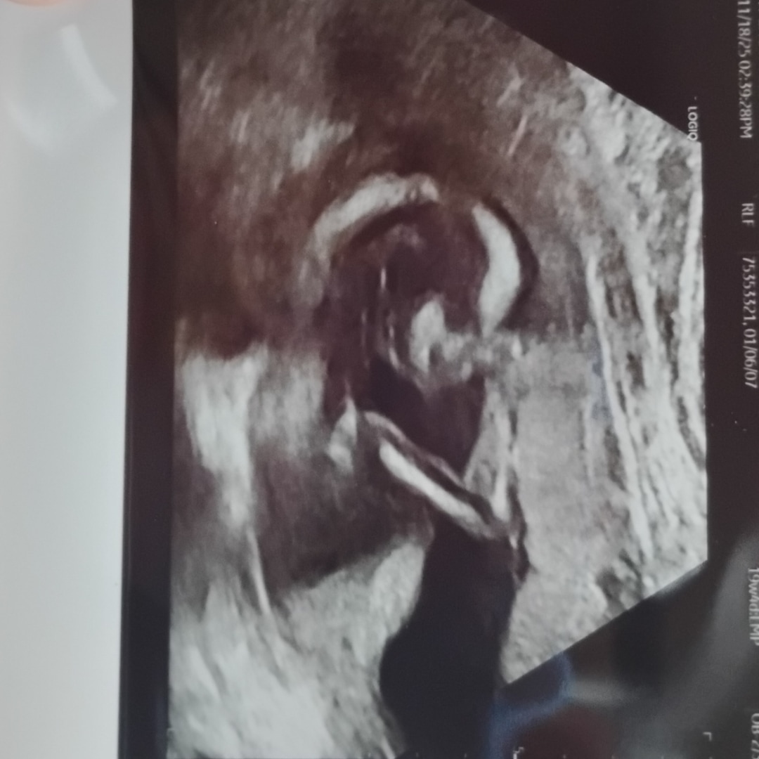 Photo shared by Zoey for their Babylist baby registry.