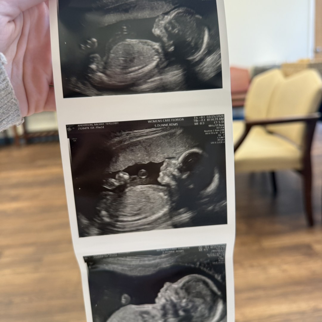 Photo shared by Aalyah for their Babylist baby registry.