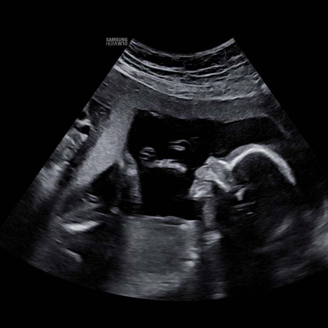 Photo shared by Lauren for their Babylist baby registry.