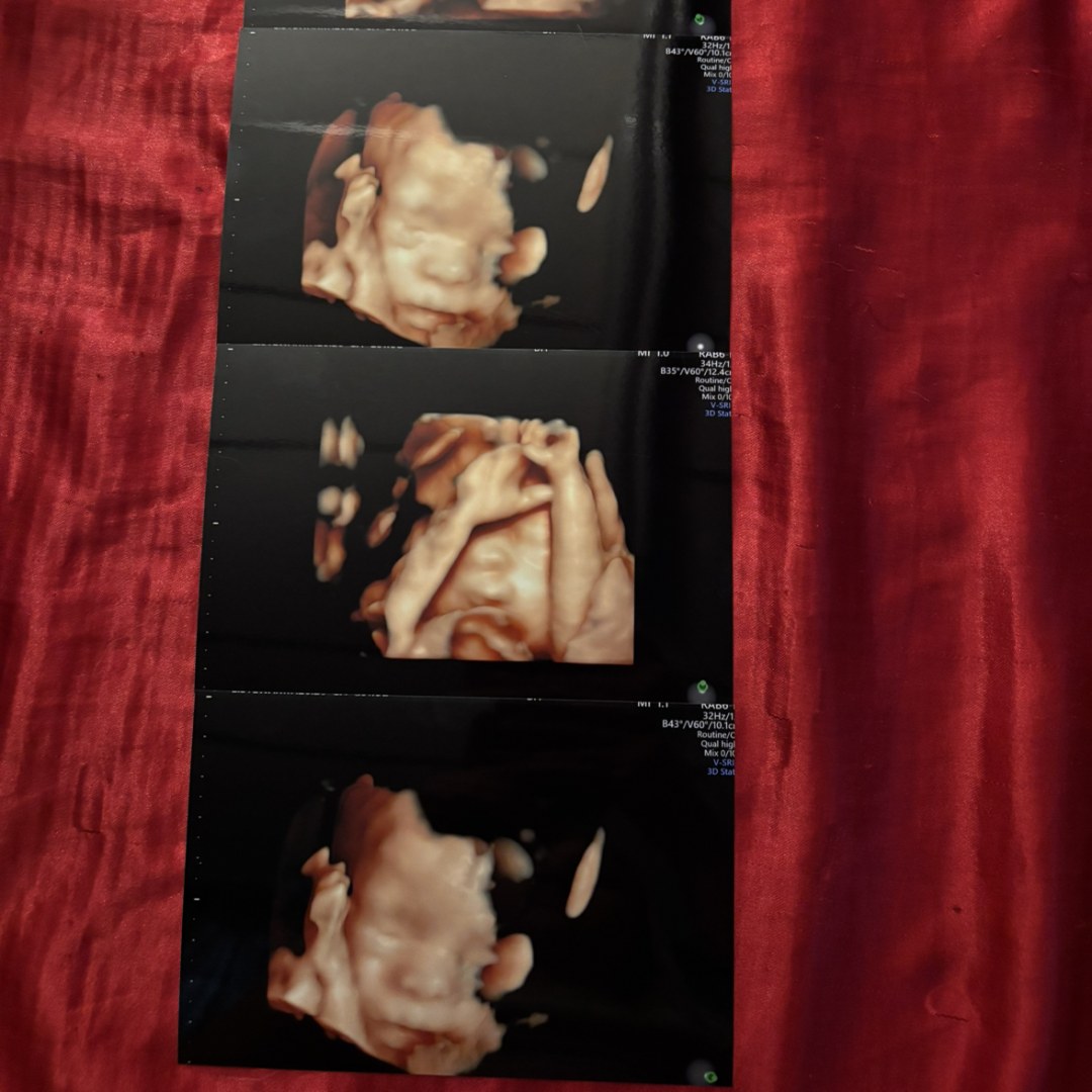 Photo shared by Ella for their Babylist baby registry.