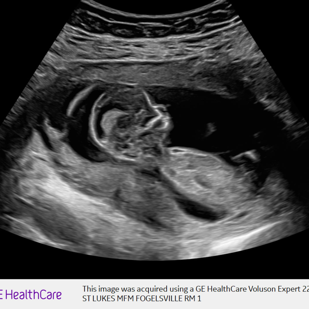 Photo shared by Maureen for their Babylist baby registry.