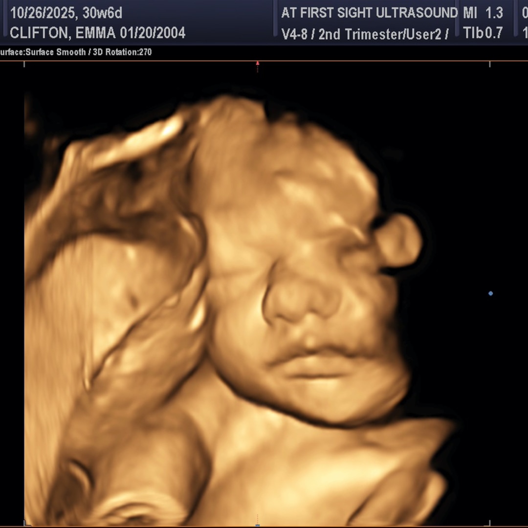 Photo shared by Emma for their Babylist baby registry.