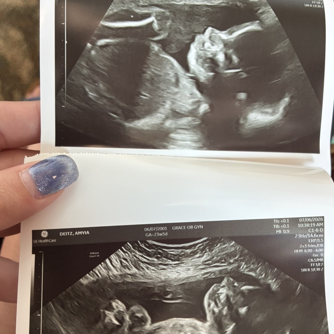 Photo shared by Amyia for their Babylist baby registry.