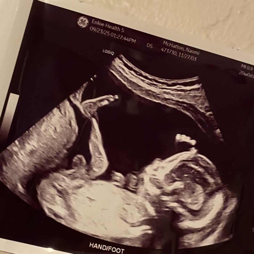 Photo shared by Naomi for their Babylist baby registry.