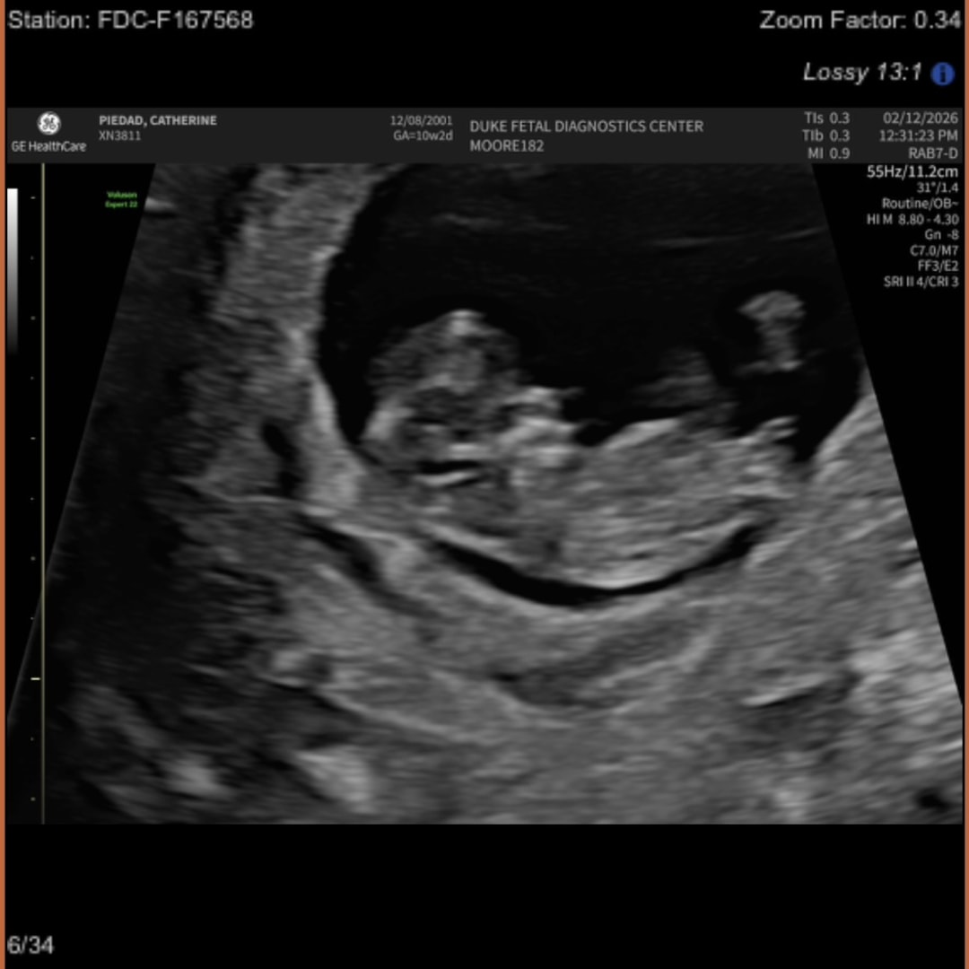 Photo shared by Catherine for their Babylist baby registry.