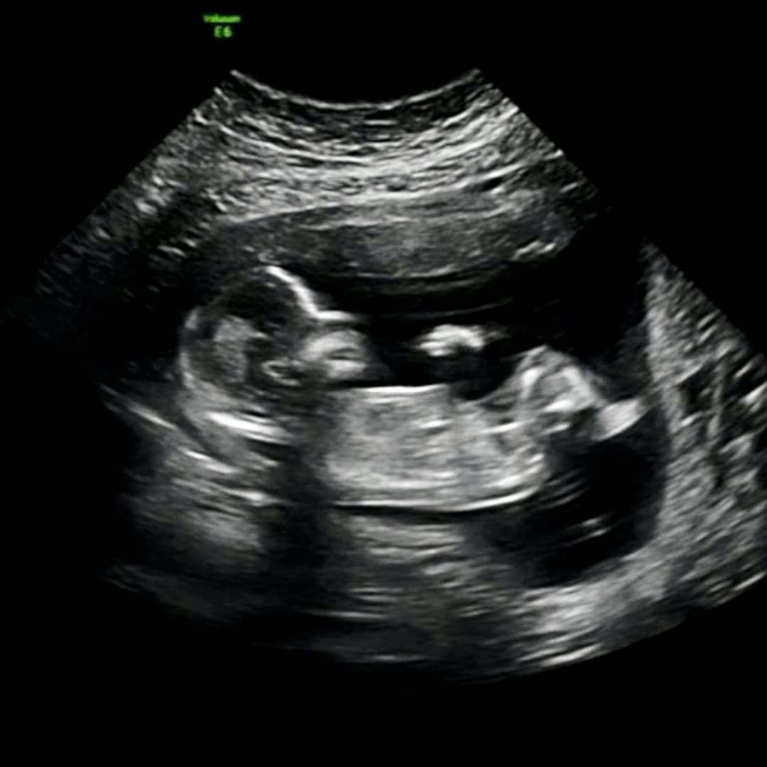 Photo shared by Brice for their Babylist baby registry.