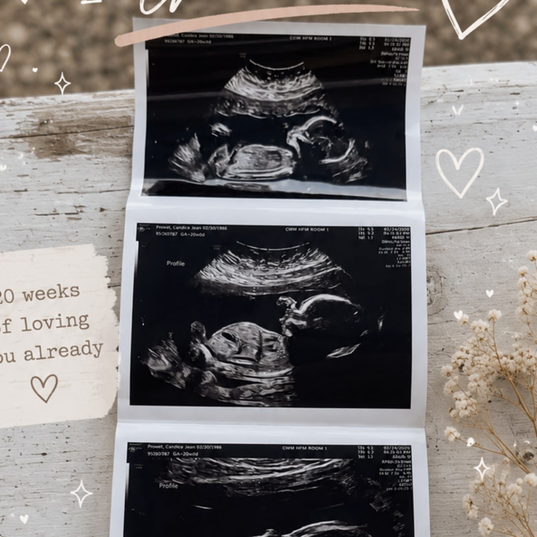 Photo shared by Candice for their Babylist baby registry.