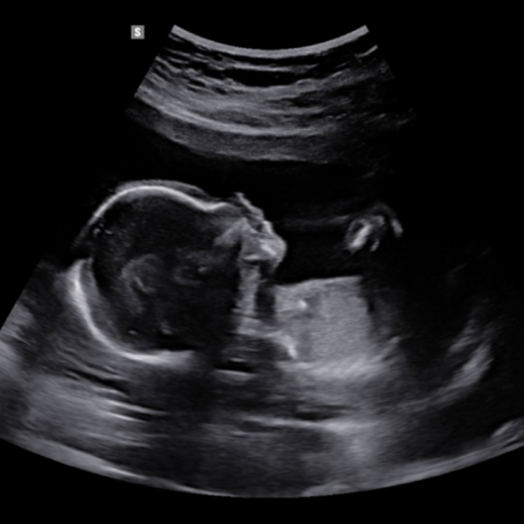 Photo shared by Carley for their Babylist baby registry.