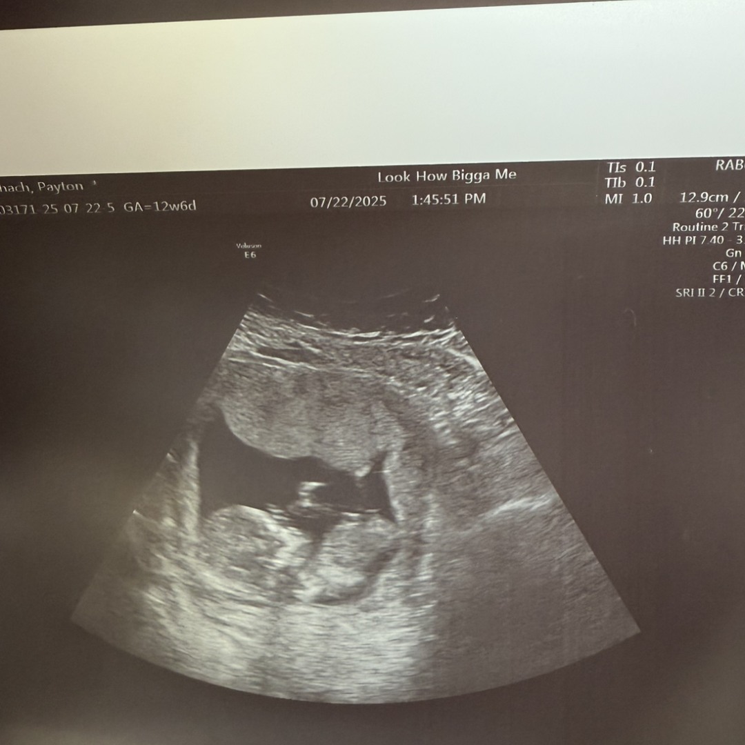 Photo shared by Payton for their Babylist baby registry.