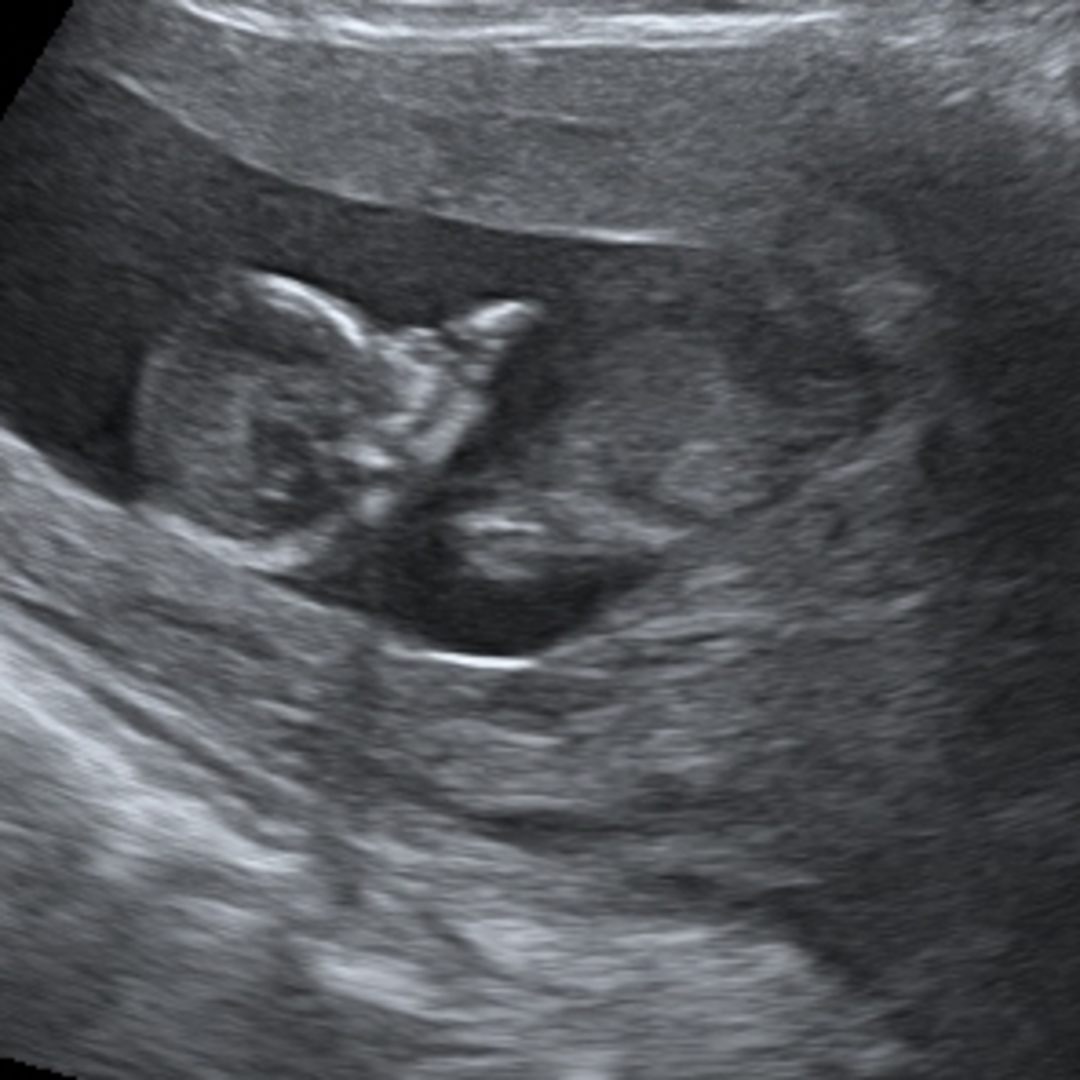 Photo shared by Ashley & Lloyd for their Babylist baby registry.