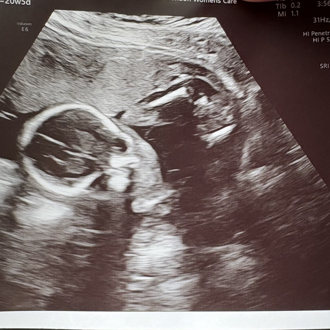 Photo shared by Jacob for their Babylist baby registry.