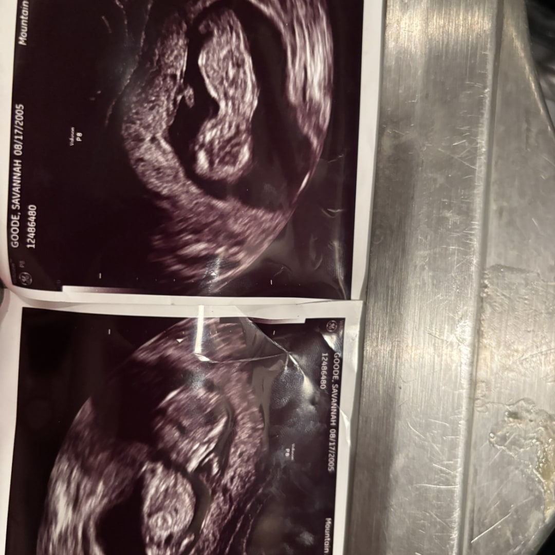 Photo shared by Aaron for their Babylist baby registry.