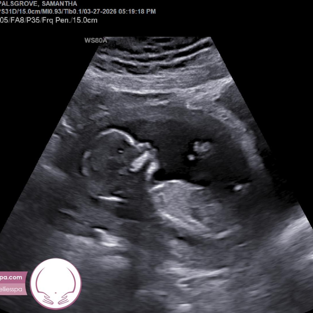 Photo shared by Samantha for their Babylist baby registry.