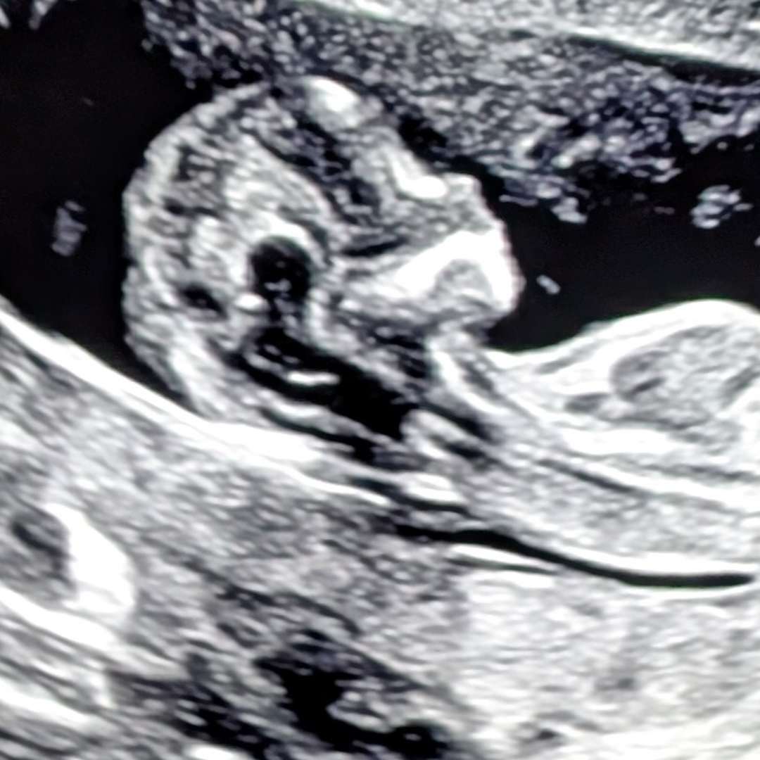 Photo shared by Danielle for their Babylist baby registry.