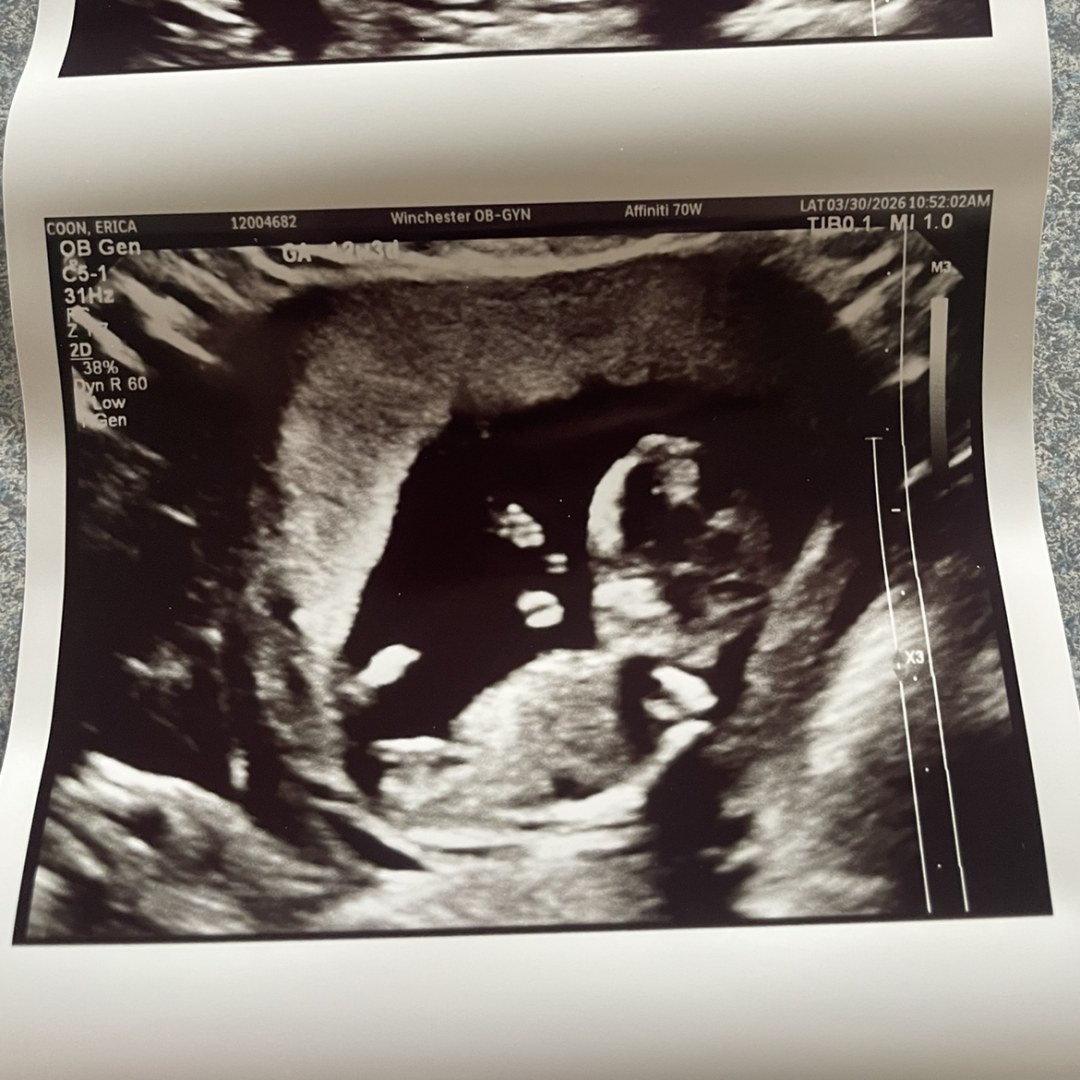 Photo shared by Erica for their Babylist baby registry.